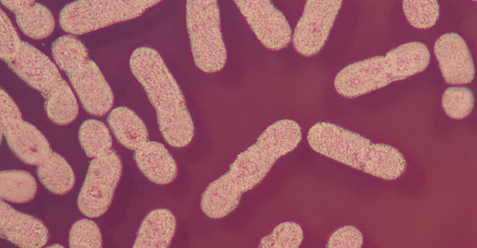 Blasenentzündung: Keim Klebsiella pneumoniae